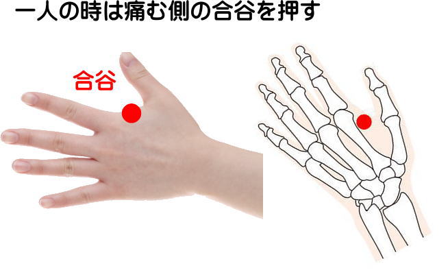 歯の痛みと合谷のイラスト