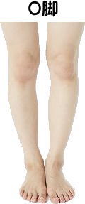 O脚