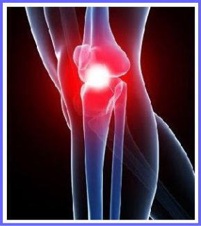 膝の痛みのイラスト