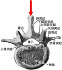 評価法　脊椎の診かたのイラスト1